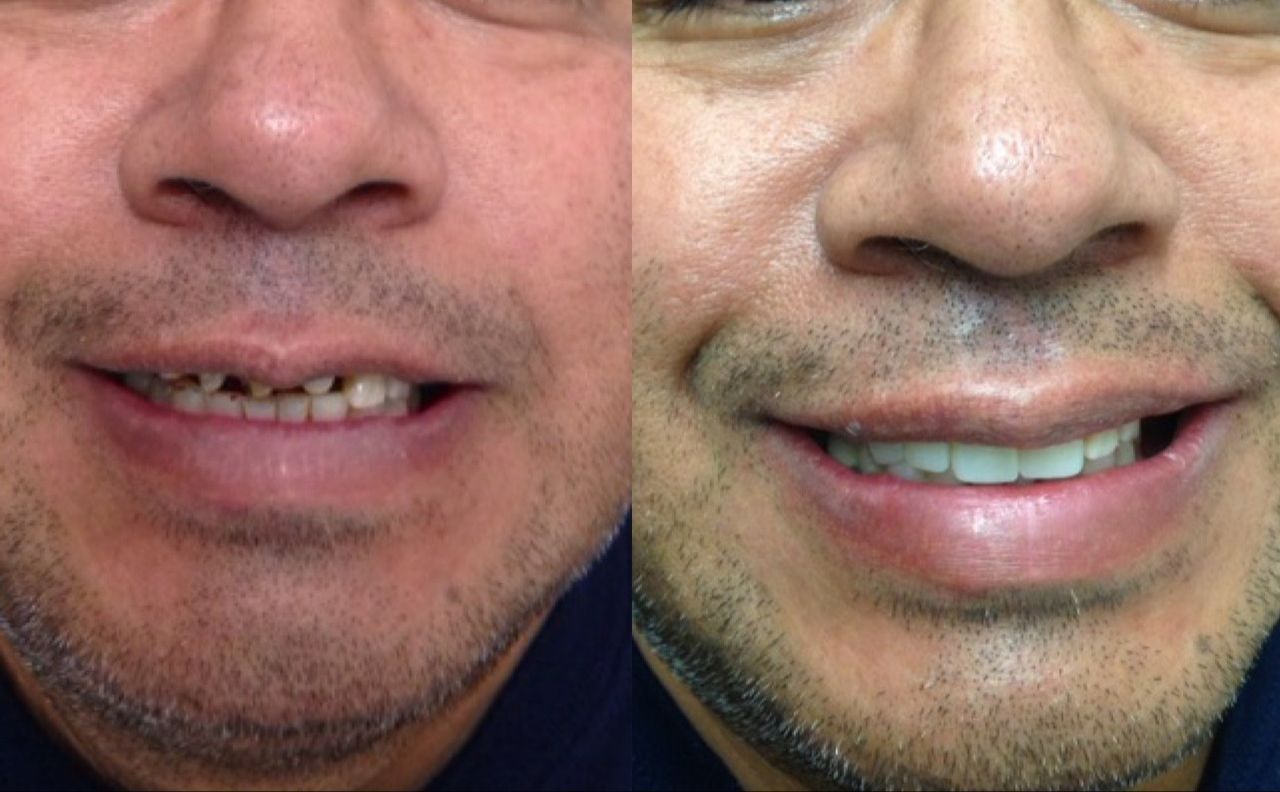 Octavio Alcántara Rangel-12