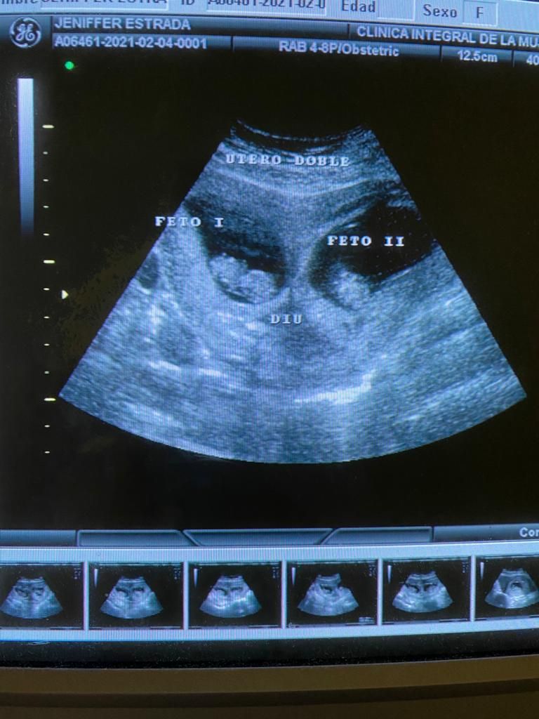 Alejandro Bailón Calderón-3