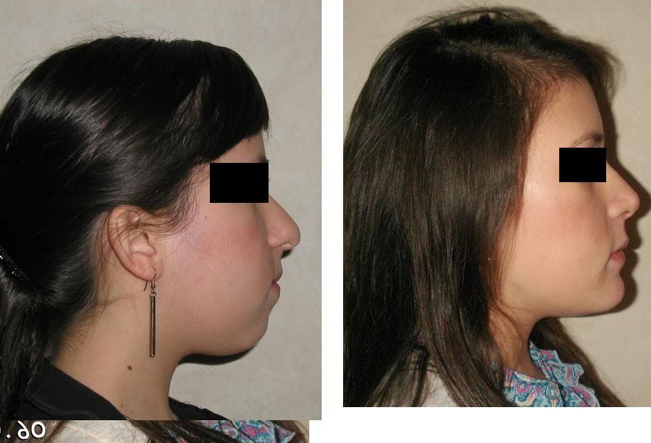 Gastón Porte Hinojosa-2