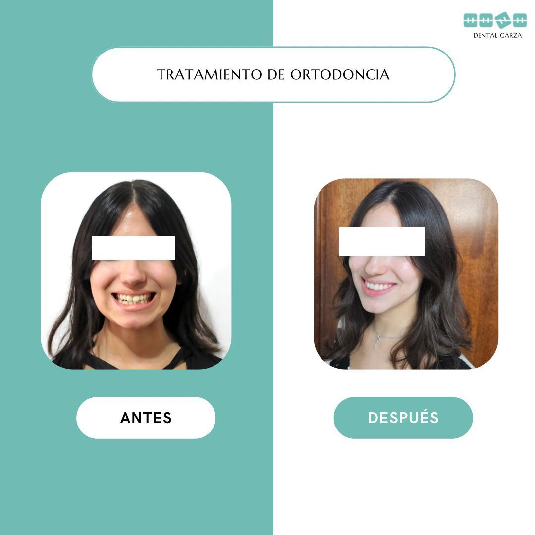 Lisette Garza Ponce-5