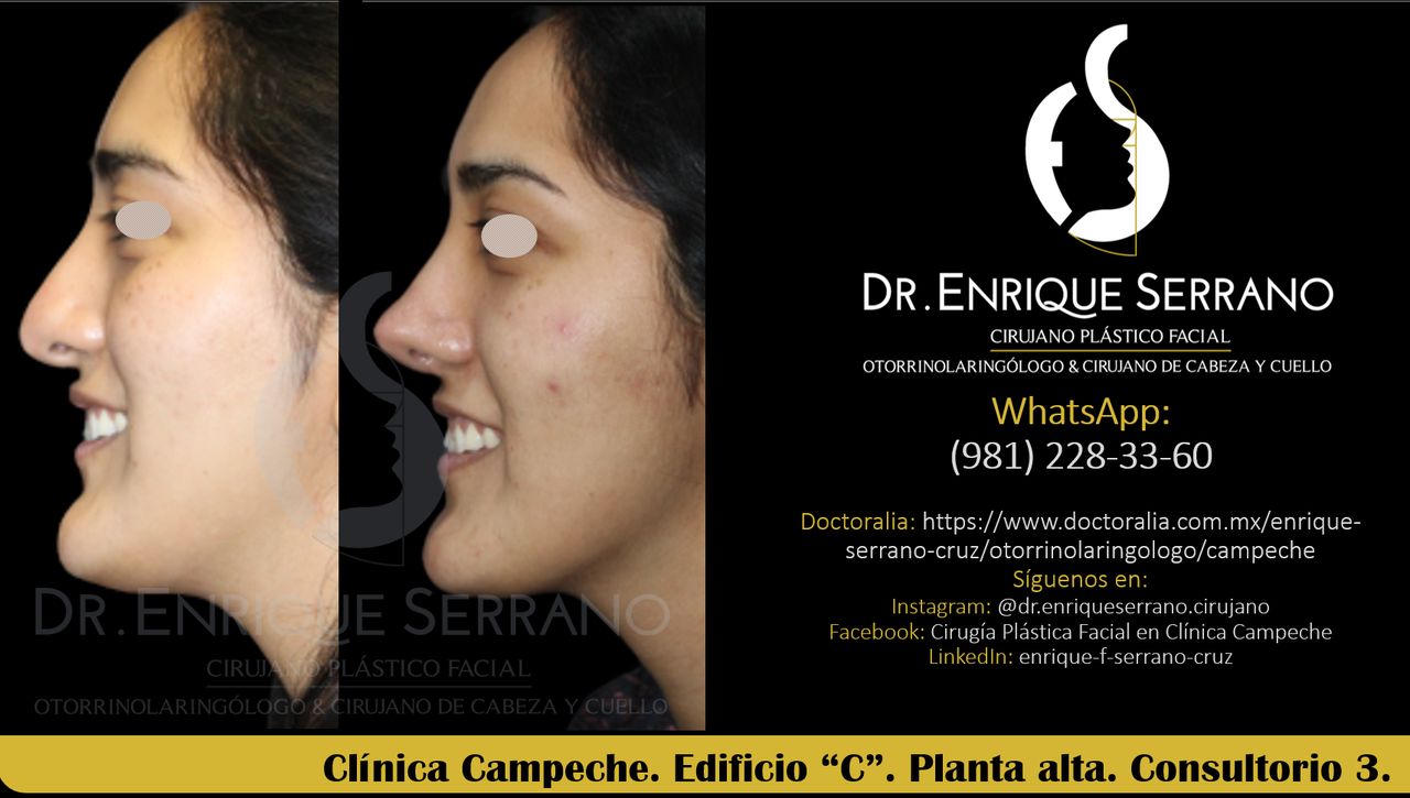 Enrique Serrano Cruz-62