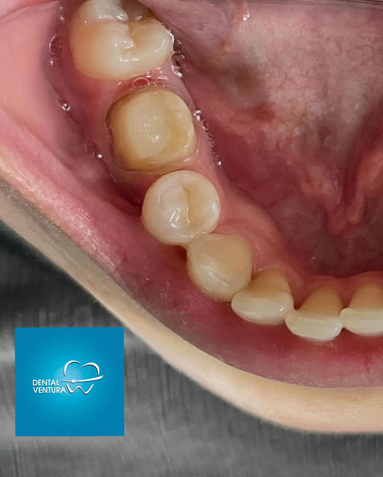 Antonio Cerda Ventura-1