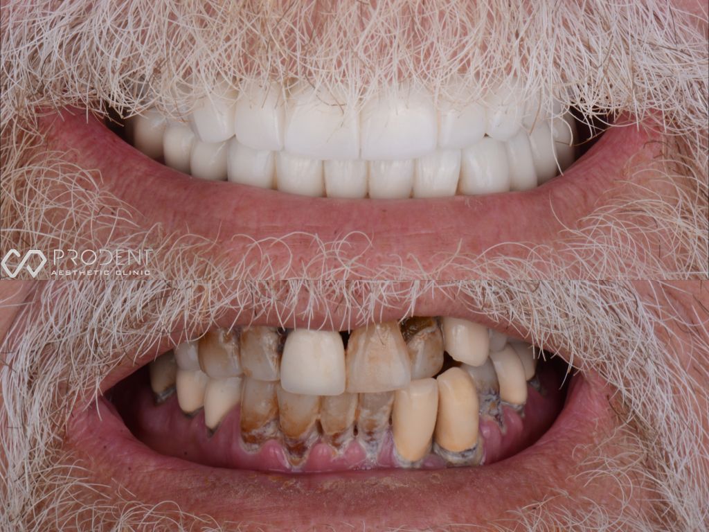 Ulises Pérez Murillo-90