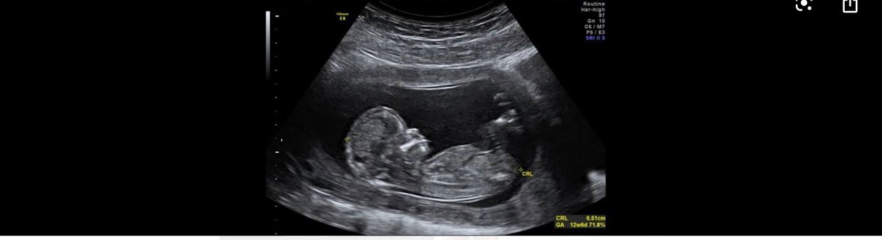 Roberto Chaparro Mejía-5