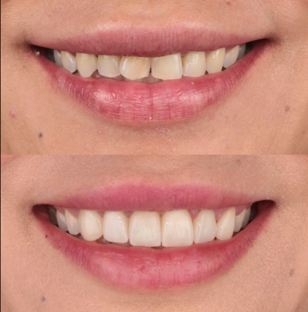 Aide Montserrat Orozco Gutierrez-21