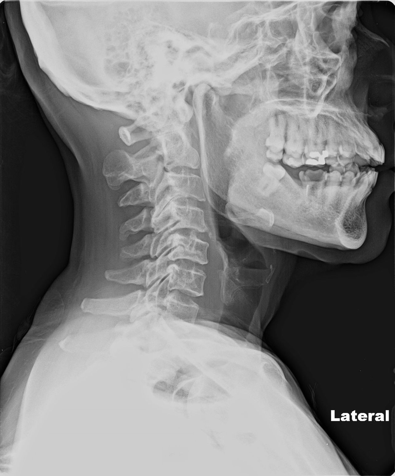 Lizeth Patricia Mena Rivas-13