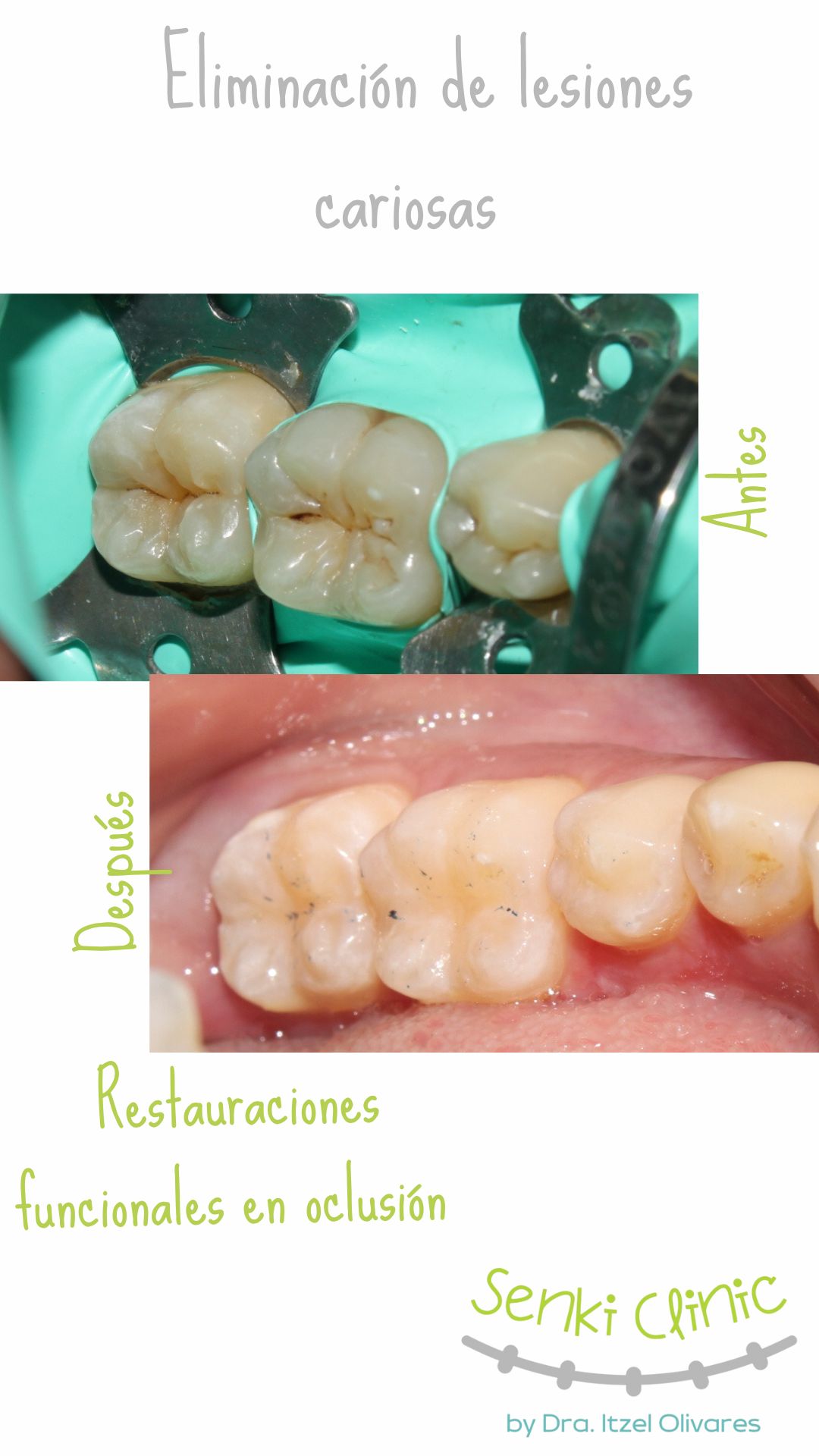 Itzel Olivares Lara-19