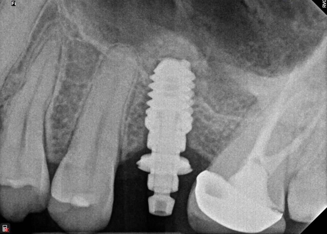 Mariela Fuentes Astudillo-0