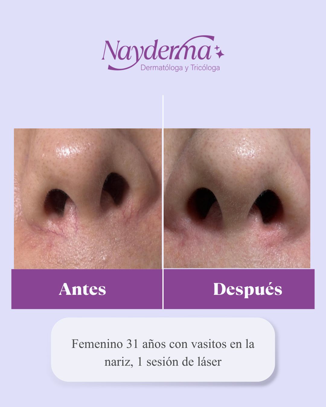 Nayra Aviña Padilla-6