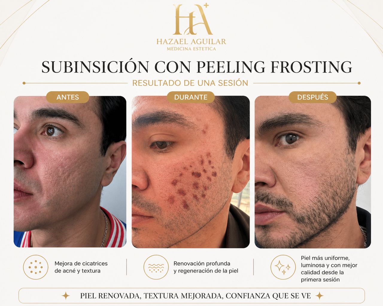 Sinue Hazael  Aguilar Hernández -10