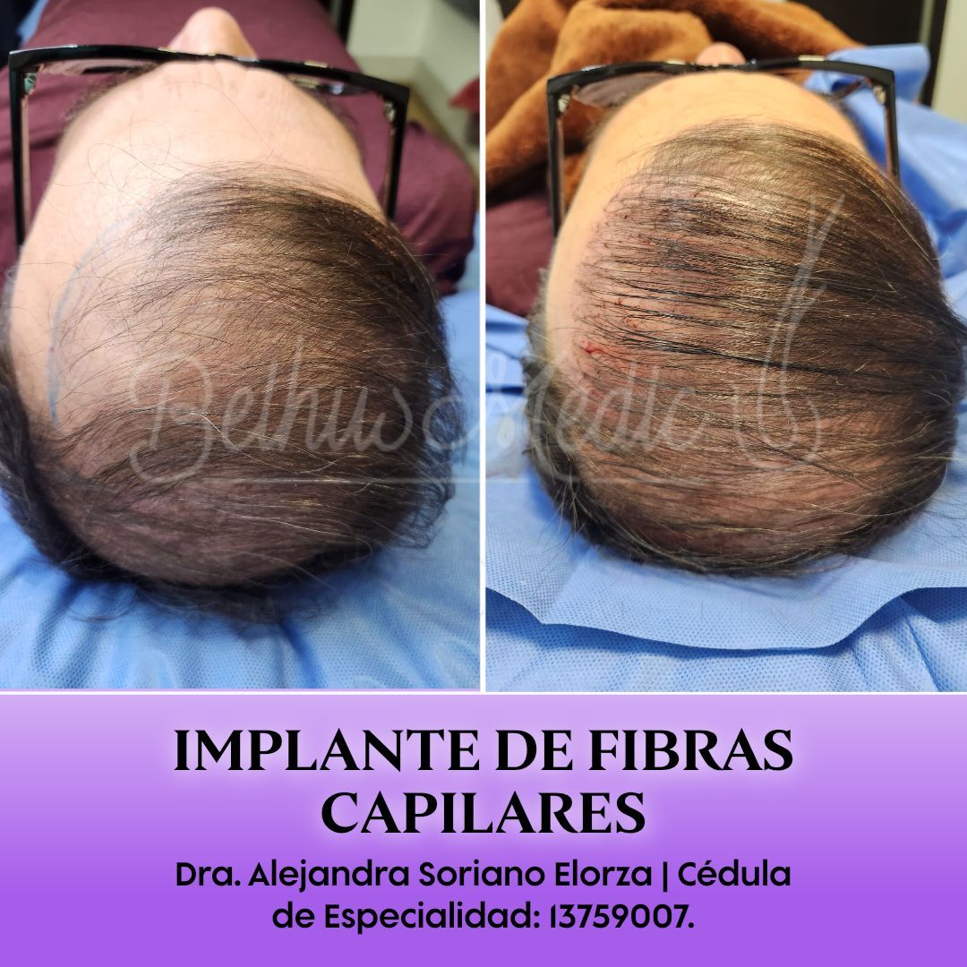 Alejandra Soriano Elorza-68