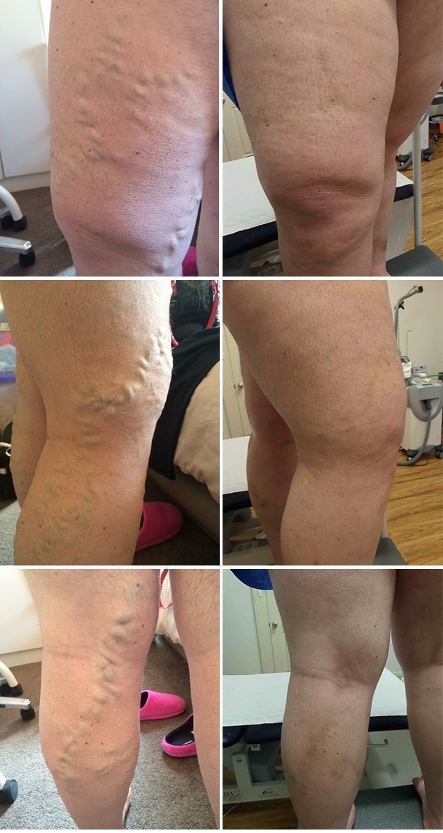 Bryan Nicolás Orozco Rangel-0