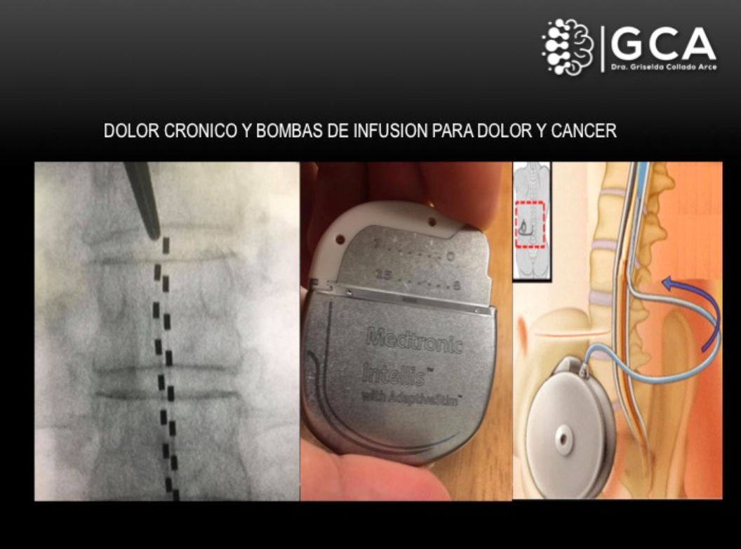 Griselda Collado Arce-30