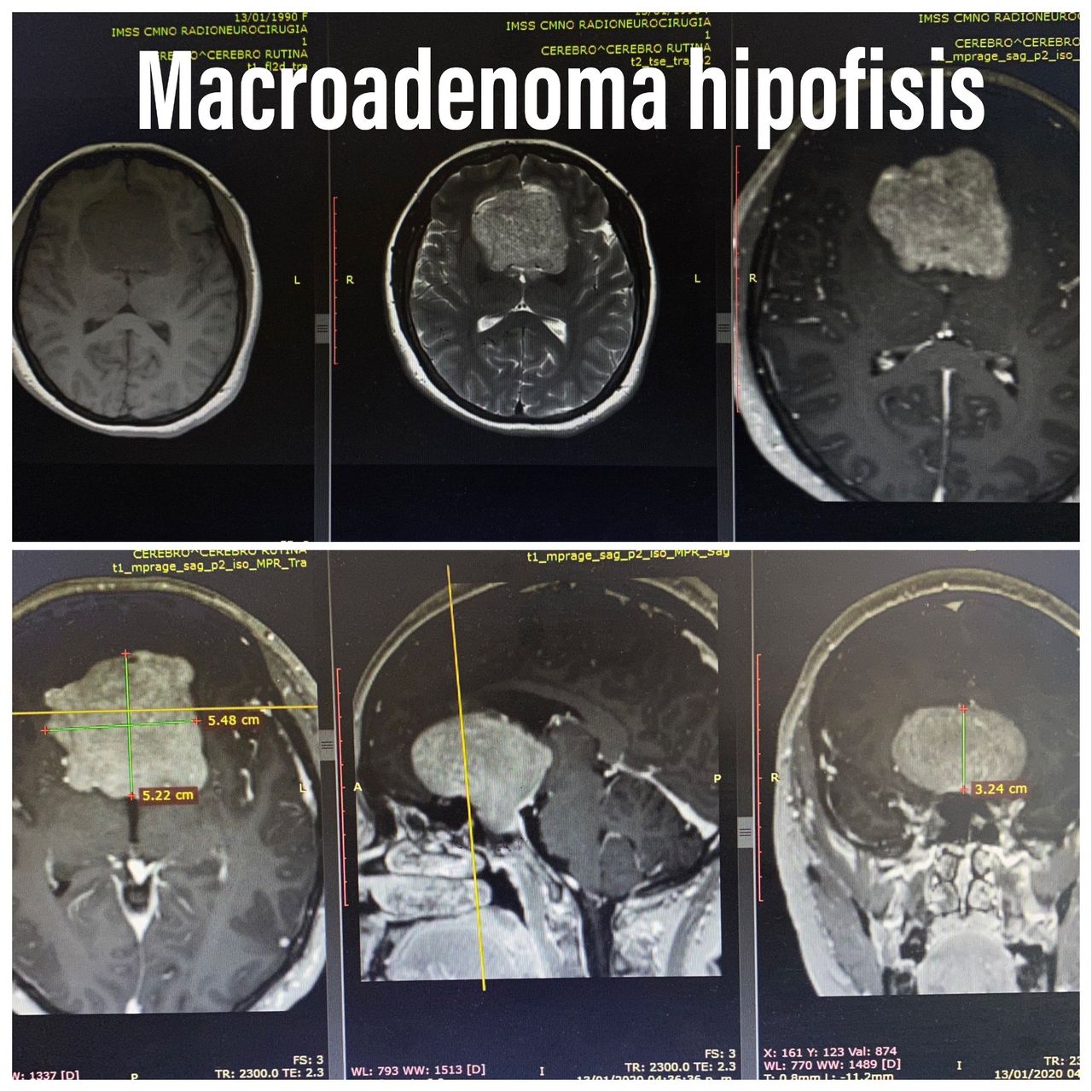 Michelle Omar Calderon Sánchez-17