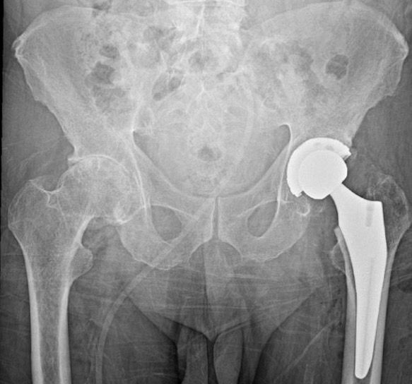 Alejandro Martínez Ramírez-35