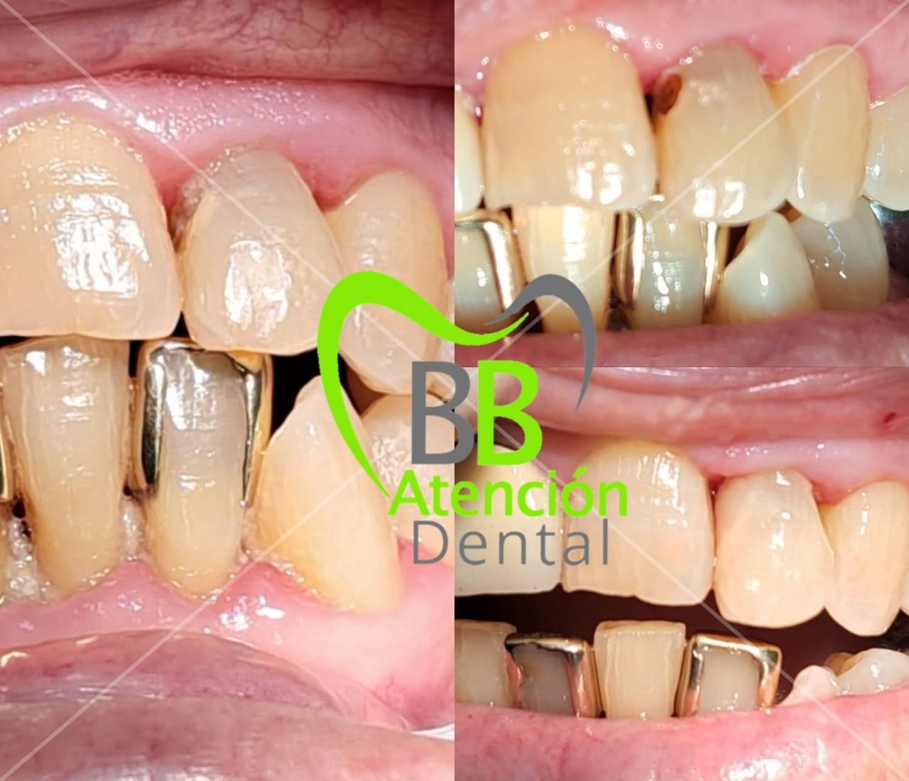 Brenda Giselle Balderas Escobedo-0