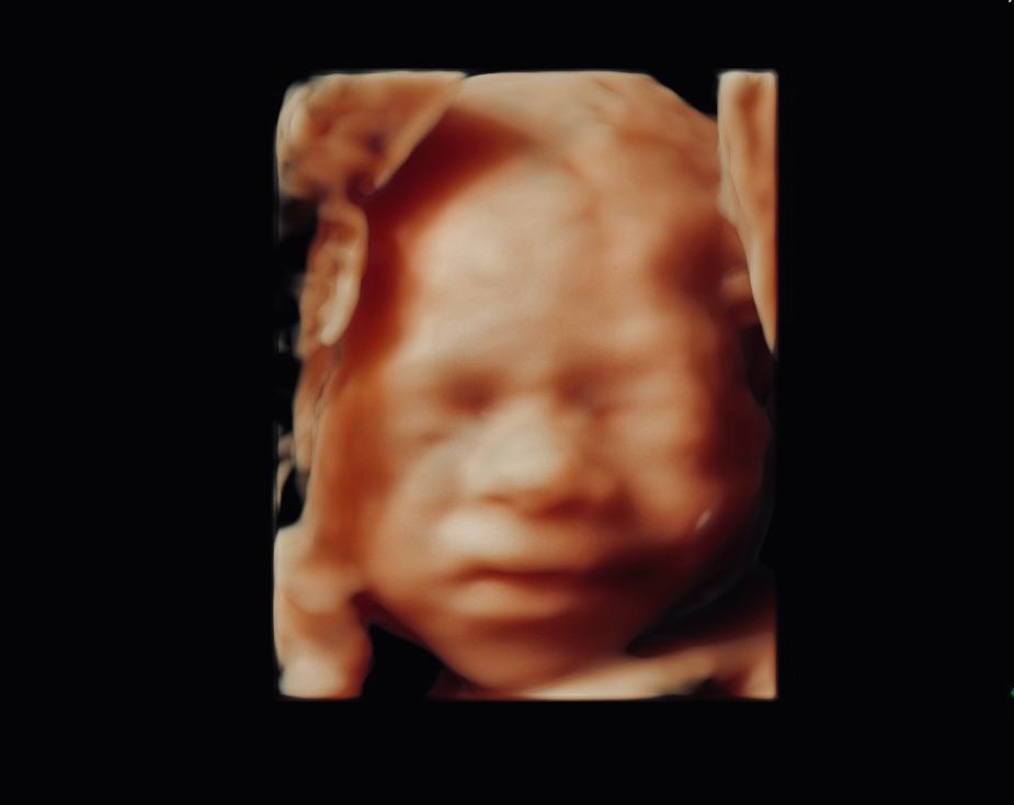 Erik Fernando González Martínez-3