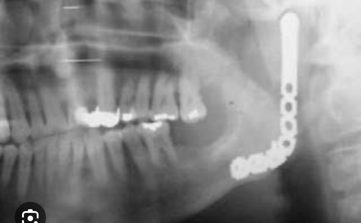 Erendalhi Rocha Mesta-7