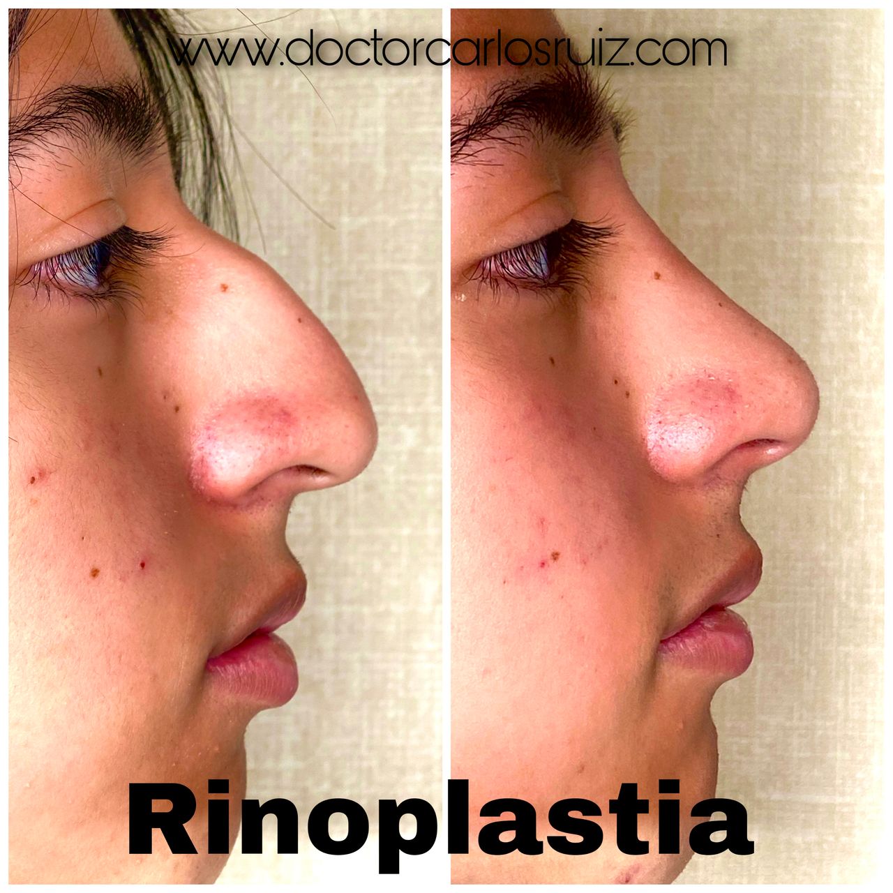 Carlos Alberto Ruiz Zepeda-3