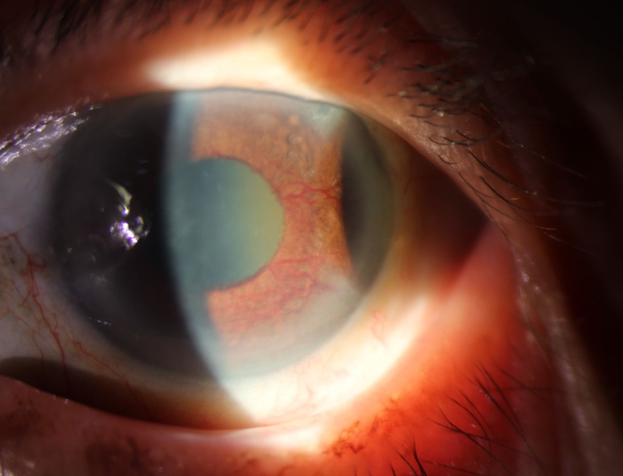 Kalid Barush Hernández Diaz-4