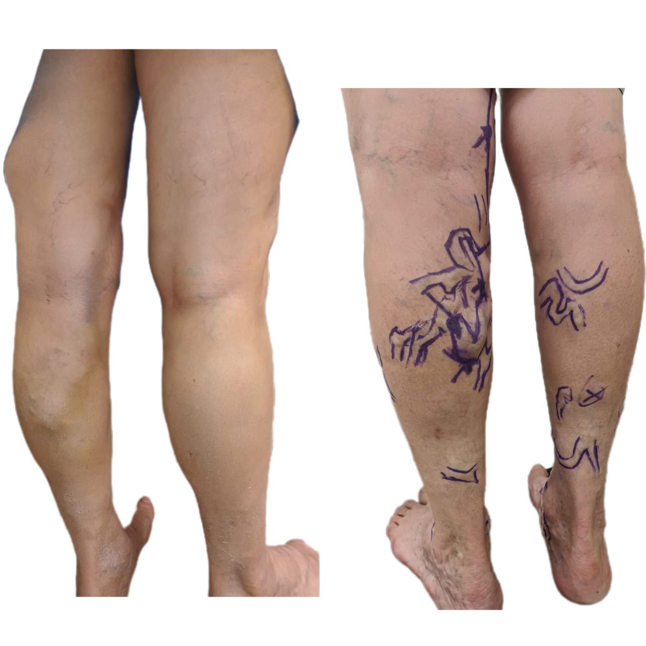 Miguel Abraham Lara Perez-3