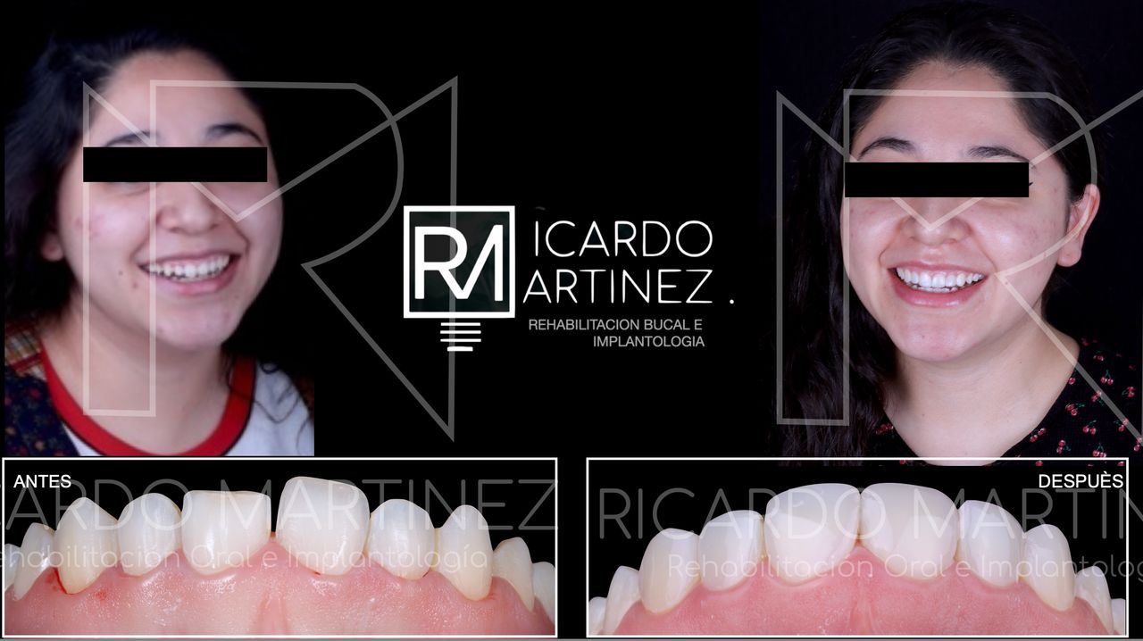 J. Ricardo Martínez-6