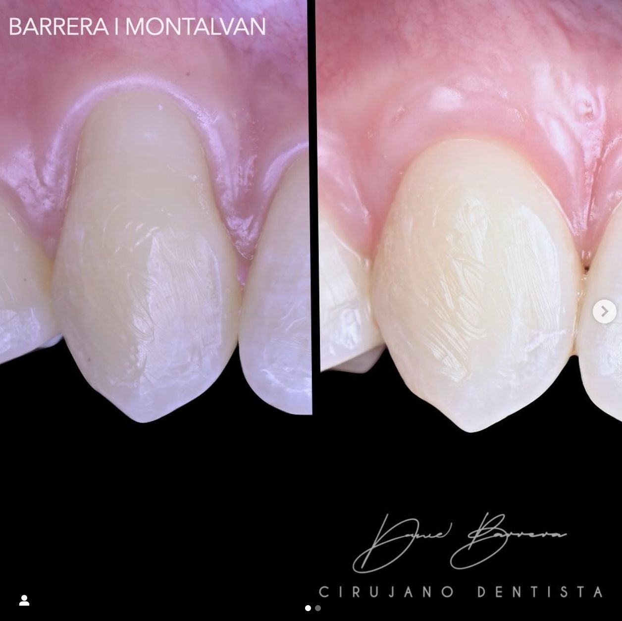 Daniel Montalván Aguilar-11