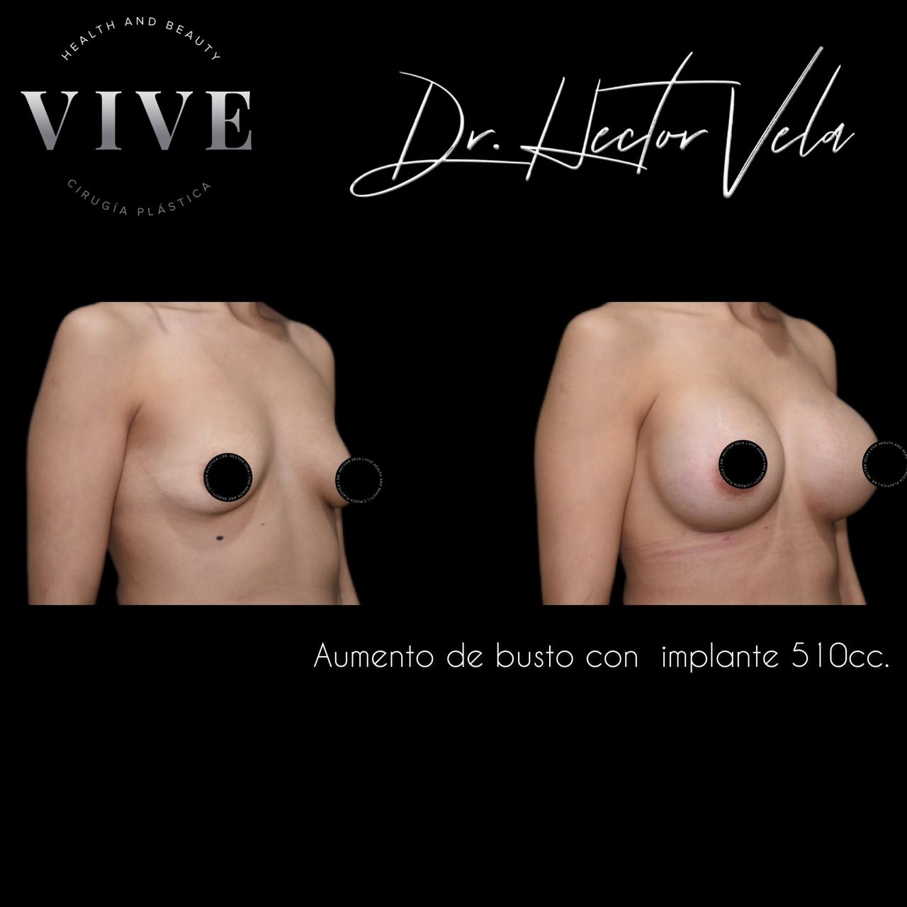 Héctor Eduardo Vela Cardona-57