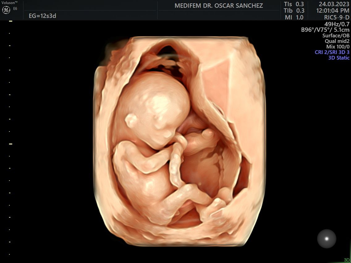 Oscar Alejandro Sánchez Gámez-4