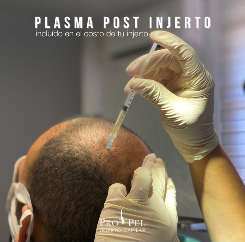 Karla Vanessa Becerra-35