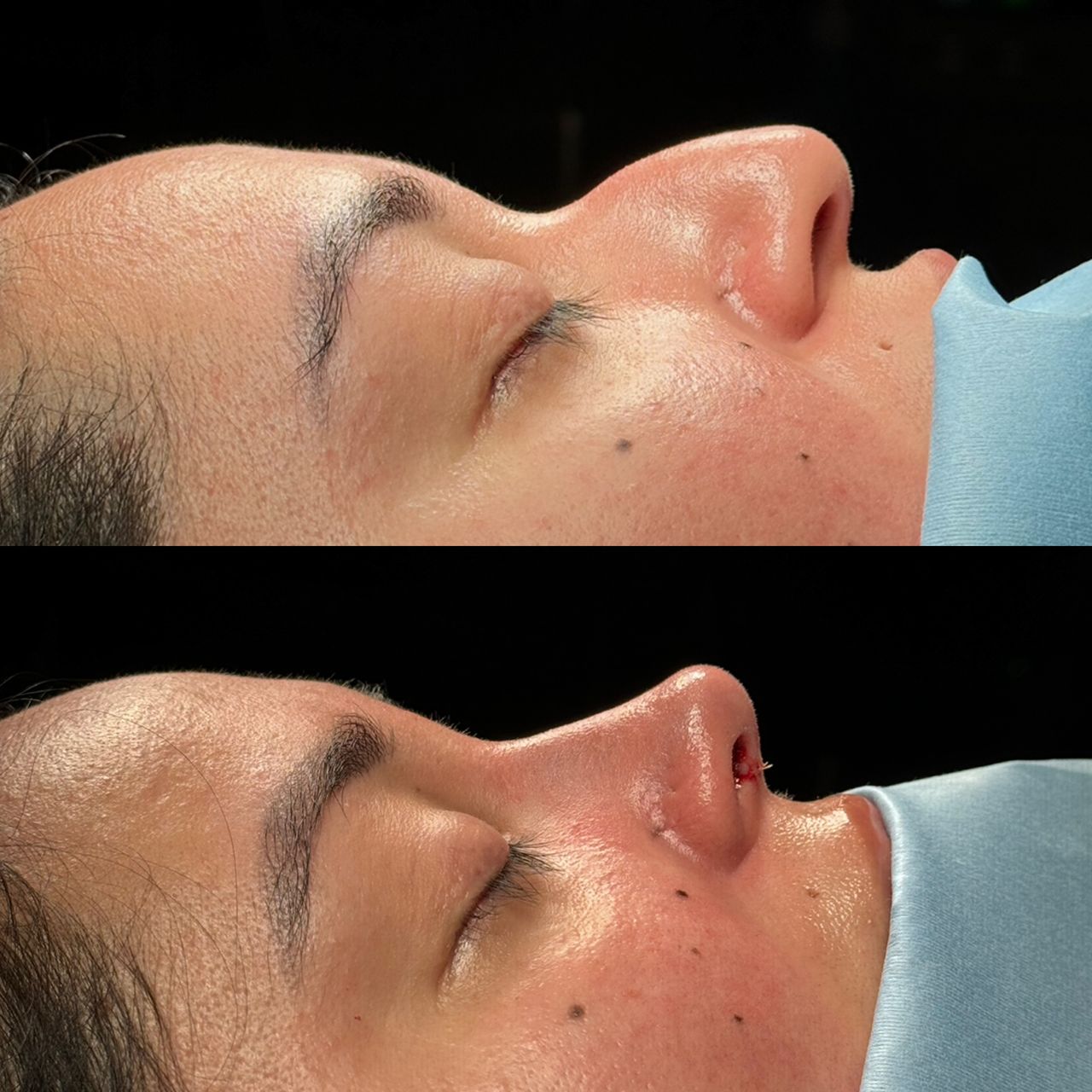 Angel Castro Urquizo-126