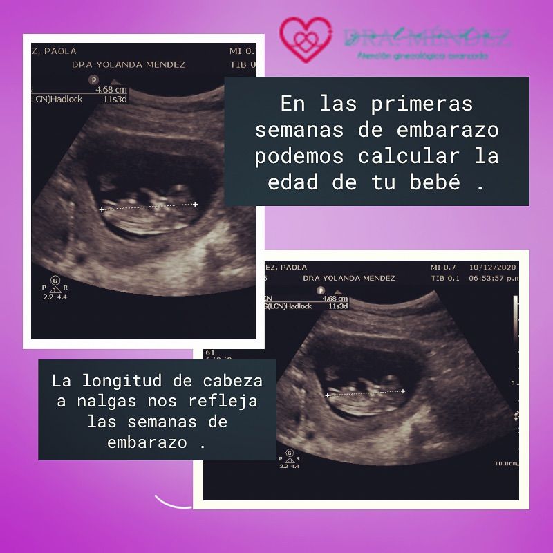 Yolanda Méndez Rodríguez-4
