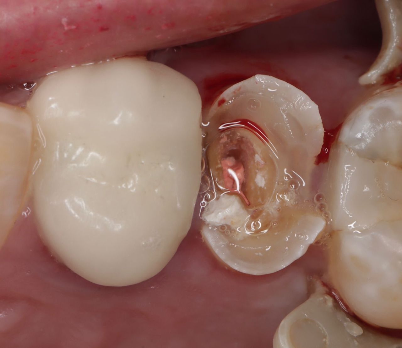 Fredy Alejandro Roblero Gónzalez-21