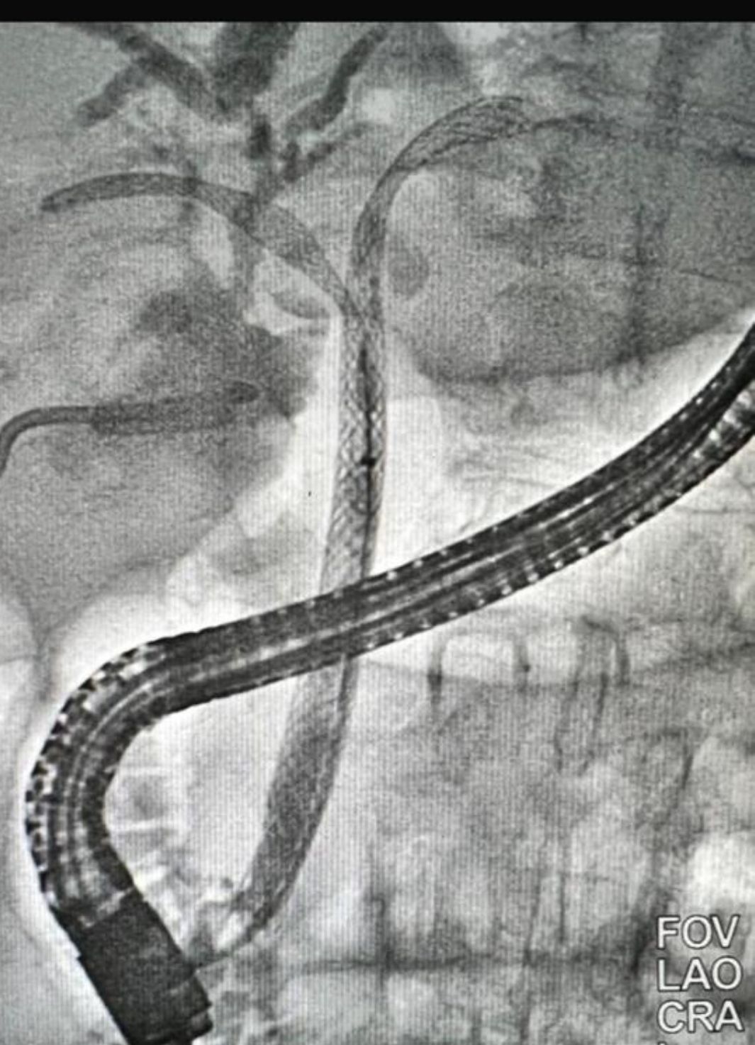 Everardo Muñoz Anaya-11