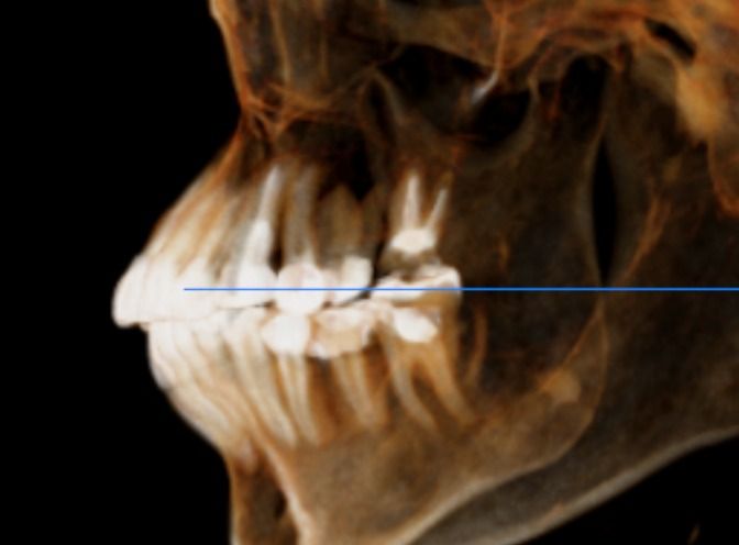 Luis Enrique Cruz Hernández-17