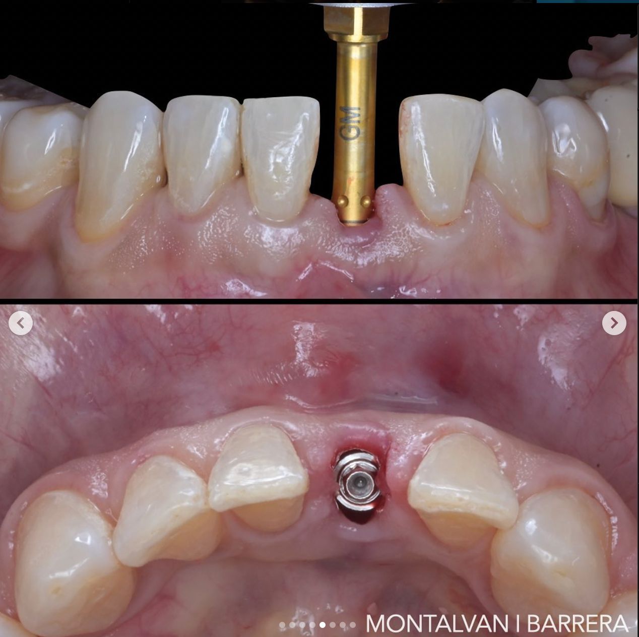 Daniel Montalván Aguilar-5