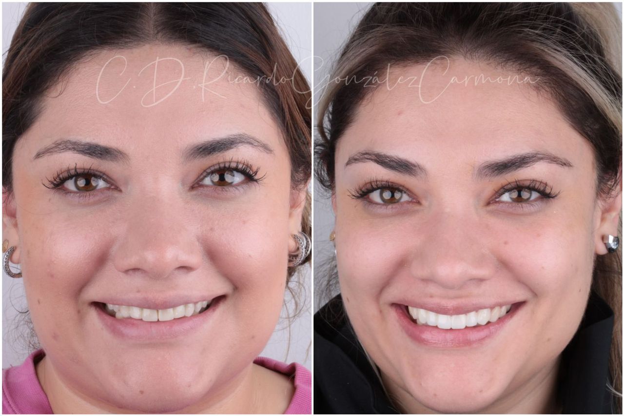 Ricardo González Carmona-9