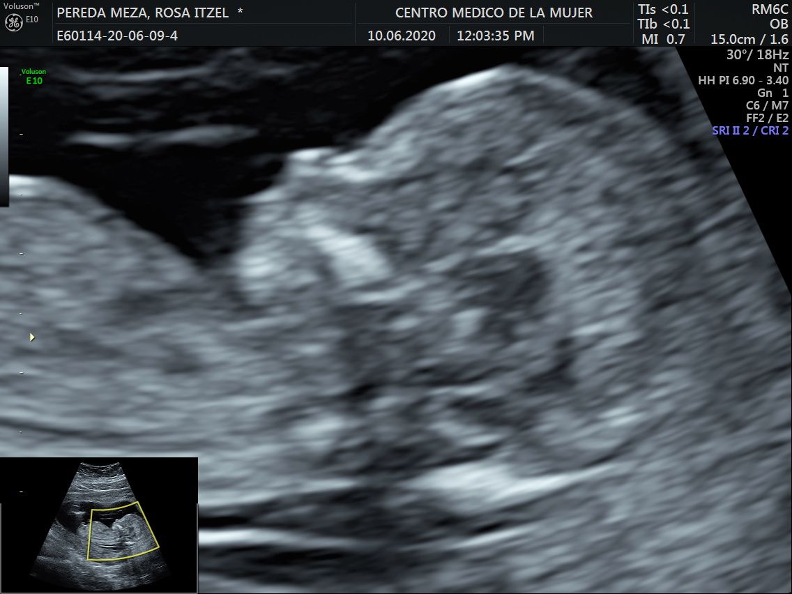 Julio Cesar Monárrez Martín-28