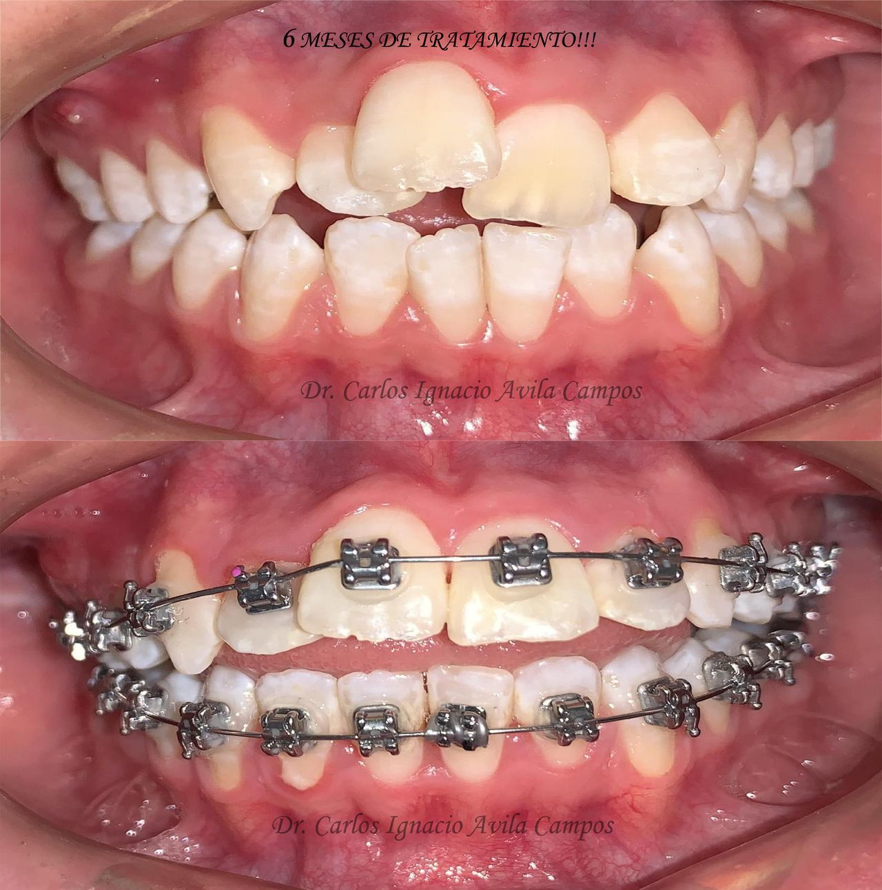 Carlos Ignacio Avila Campos-8