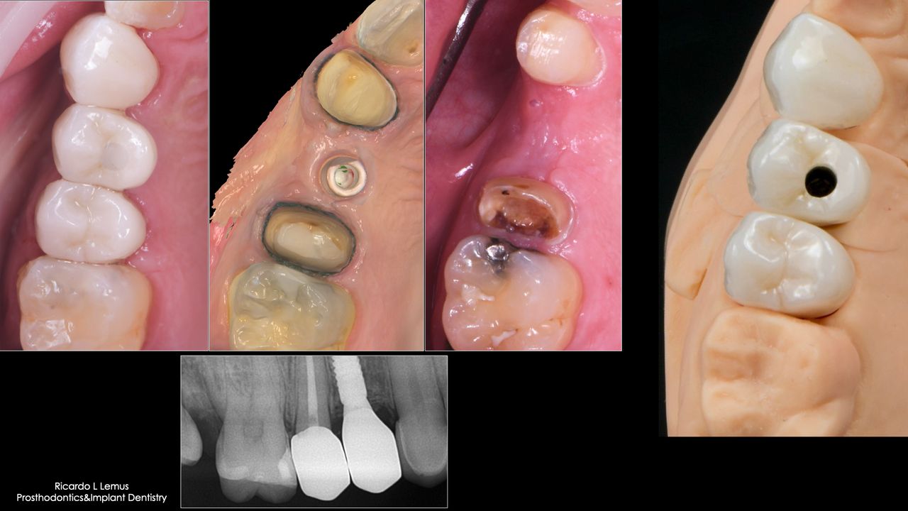 Ricardo López Lemus-124
