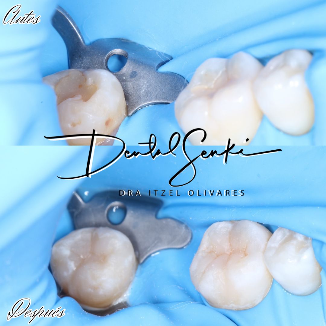 Itzel Olivares Lara-24