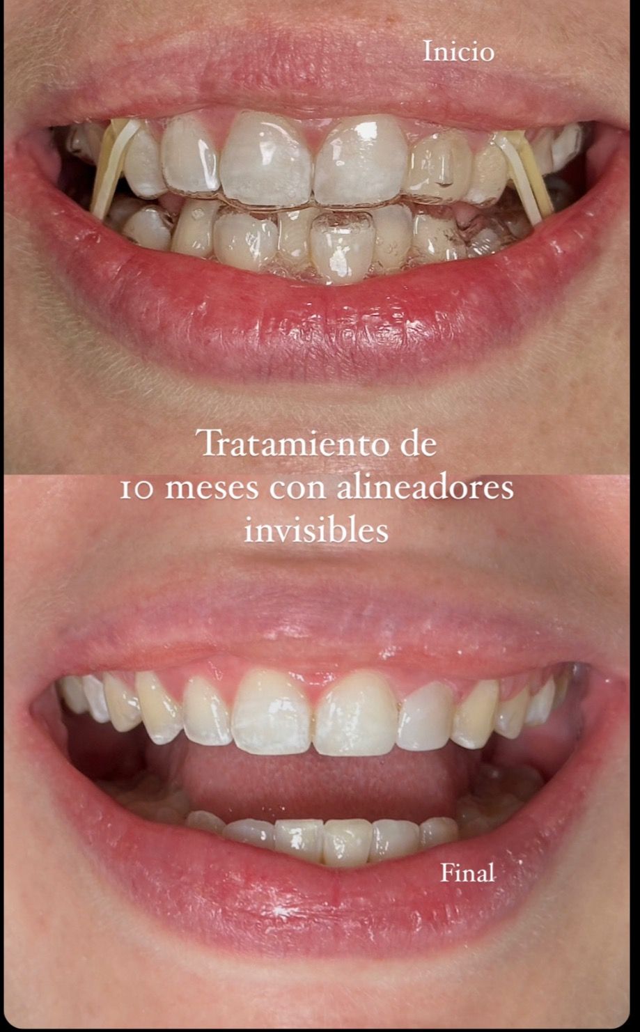 Angelica Najera Munguía-8