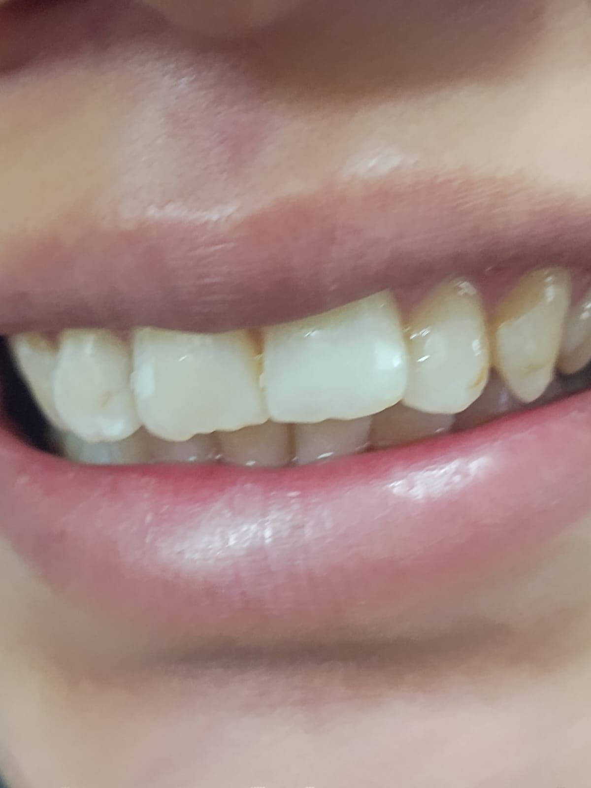 Apolo Espinoza Vega-4