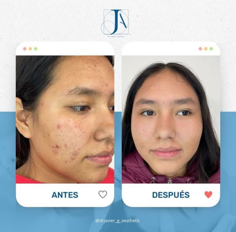 Javier Aztegui Galindo-0