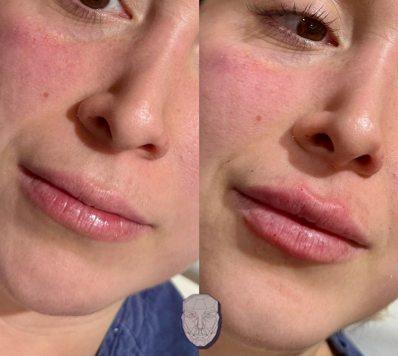 Anuar Hernández Flores-5