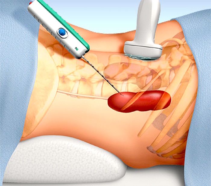 Jorge Carranza Ayala-2