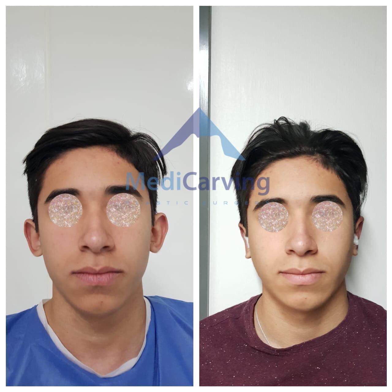 Rafael Velázquez Razo-5