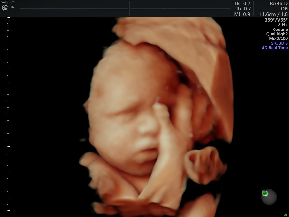 Edgardo Reyes Ponce-7