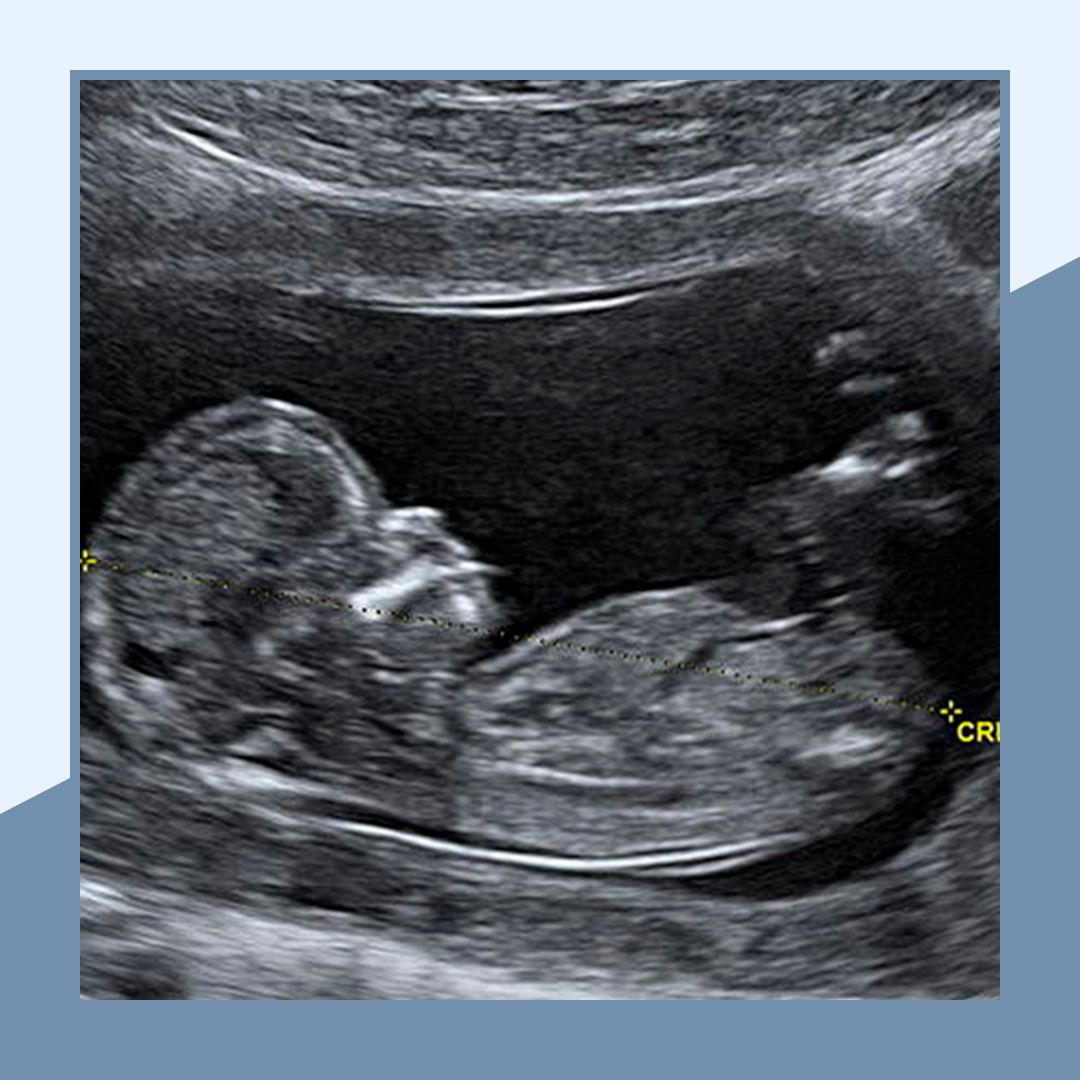 Eduardo Williams Victoria-10