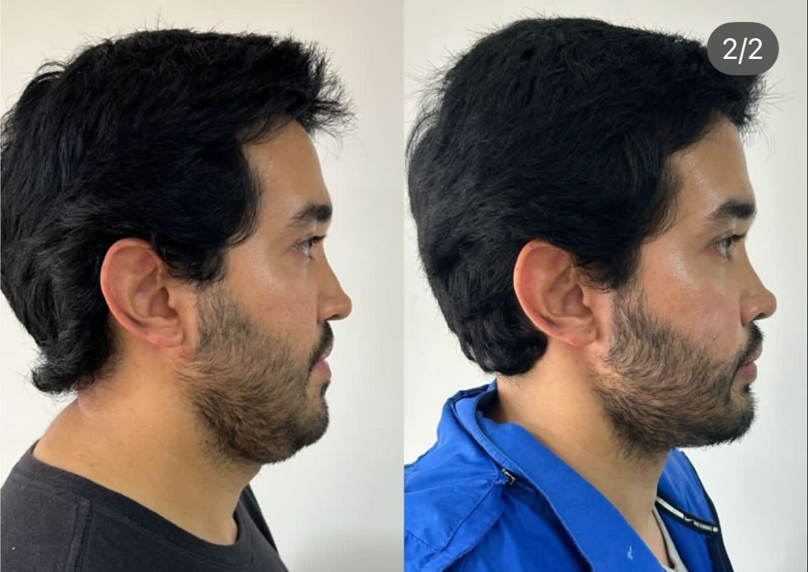 Nancy Valeria Lara Gayosso-20